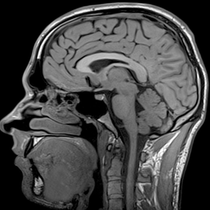 Кт головы стоя. Мрт мягких тканей головы. M67 MRI. Мрт головного мозга. Мрт мозга.